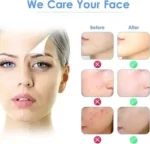 Pala Limpieza Facial Ultrasonica