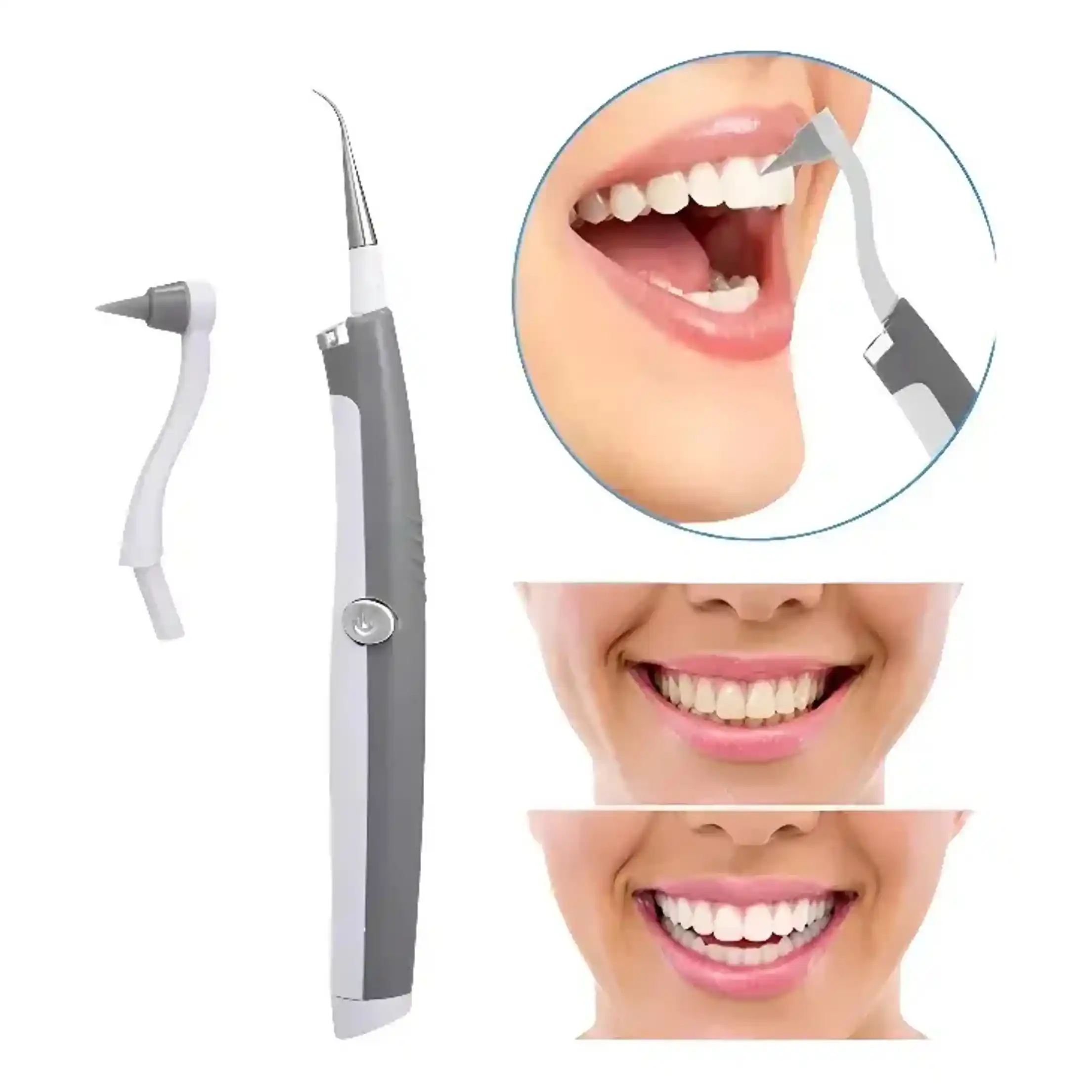 Limpiador Dental Ultrasonico