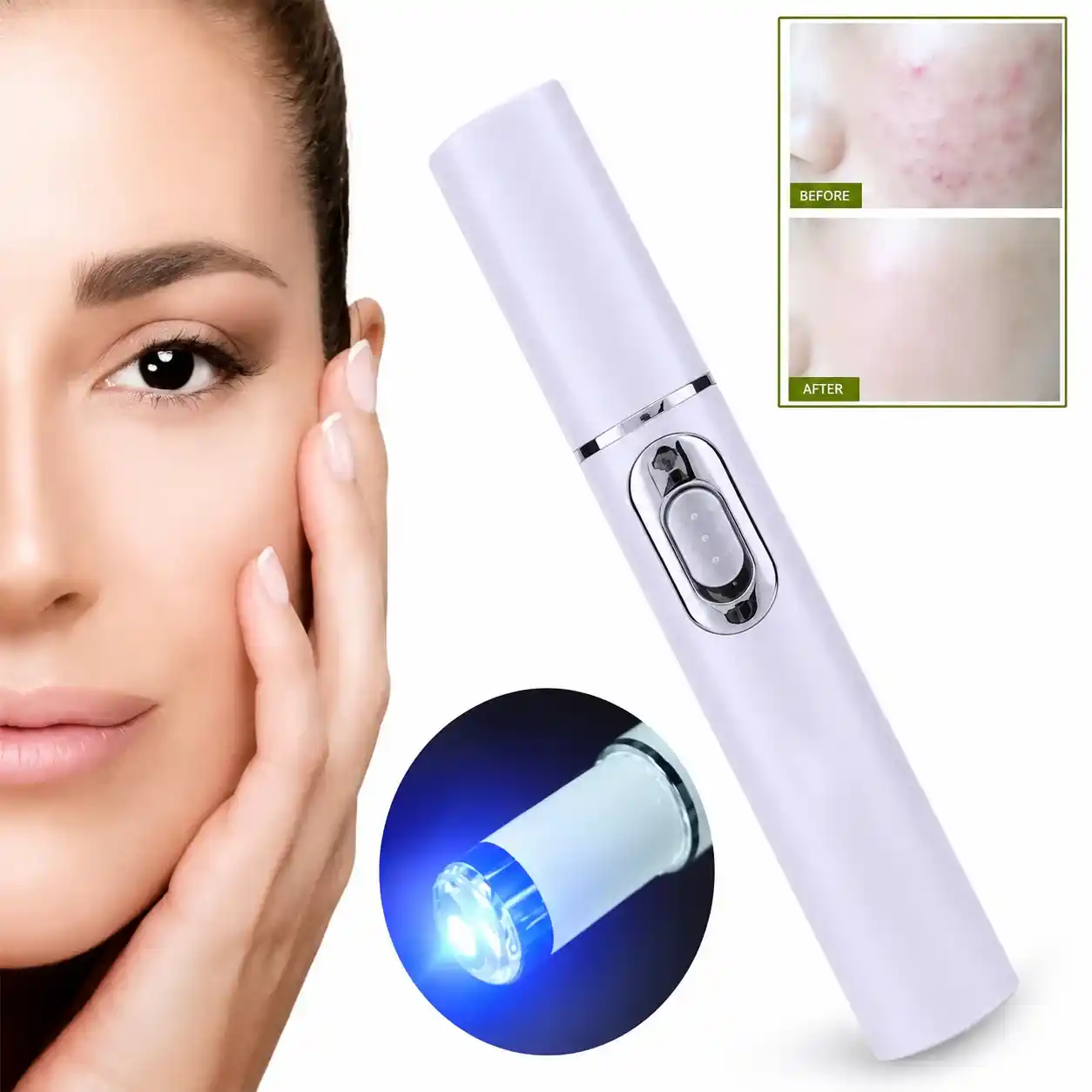 Lapiz Laser Facial